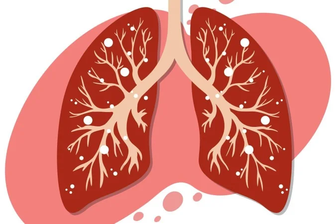 1_t3i7-vhfo-230103-60449005