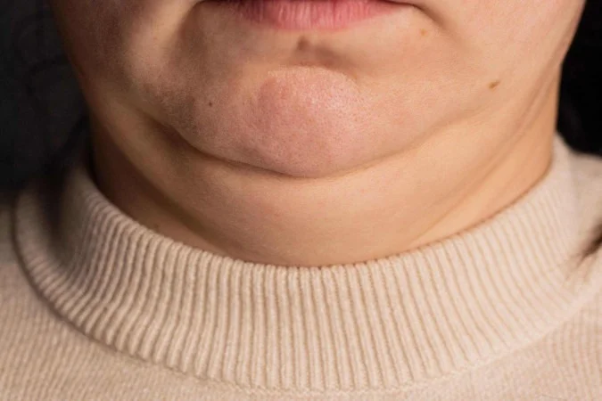 1_ed9c9c60-b31e-11f0-97c8-db772e271405-60556358