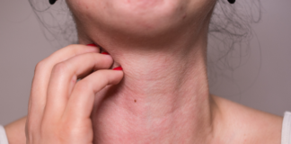 Alergia: quando o medicamento vira risco