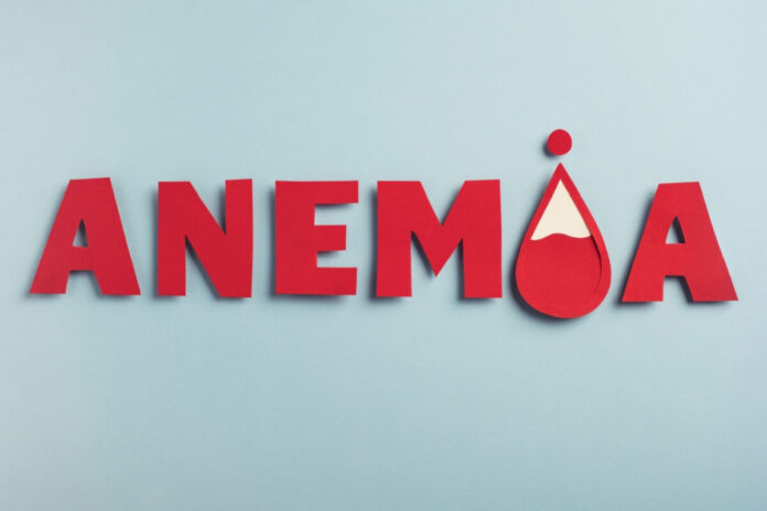 anemia