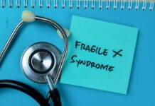 Síndrome do X Frágil: conheça as causas e os sintomas