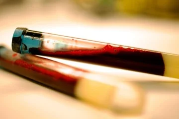 1_blodprov-banner-foto-nicola-pietro-montaldo-63769679