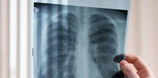 Obesidade e inflamação aceleram envelhecimento dos pulmões, mostra estudo