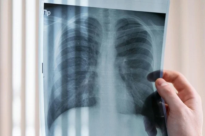 1_pexels-cottonbro-7579829-57908704