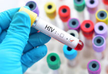 Queda da ajuda internacional coloca luta contra HIV em risco, diz ONU