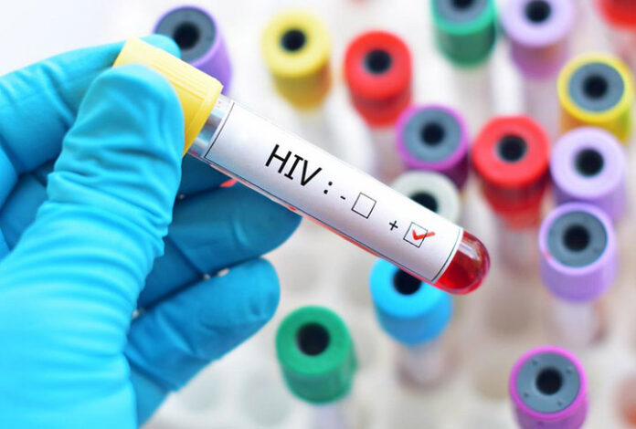04 AIDS-HIV - PRess Serbia - Flickr