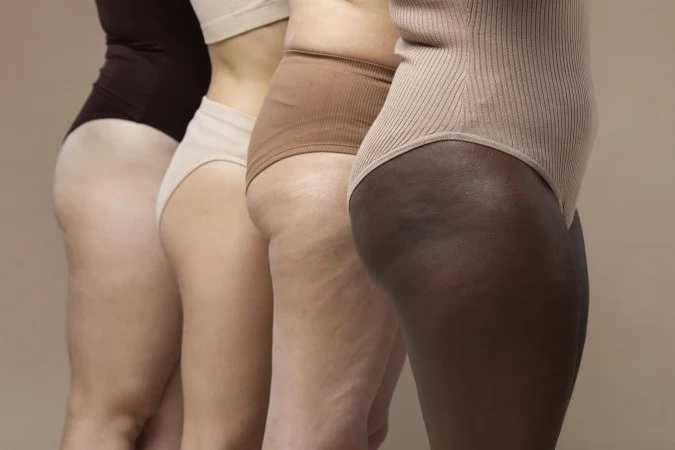 1_different-women-standing-together-66916288