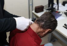 Botox oferecido pelo SUS ajuda pacientes a recuperar movimentos e qualidade de vida