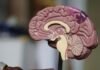 Cientistas brasileiros mapeiam 129 novos caminhos genéticos contra Alzheimer