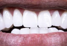 Como proteger as boas bactérias da sua boca