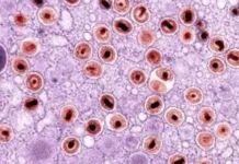 Herpes-zóster: quando uma dor comum merece atenção
