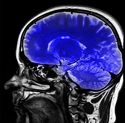cerebro-raio-x