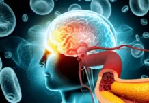 Dia Mundial do AVC: entenda como a saúde vascular ajuda a prevenir a doença